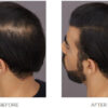 NISHMAN HAIR FIBERS BLACK 2N1 KIT