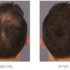 NISHMAN HAIR FIBERS BLACK 2N1 KIT